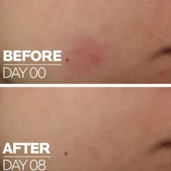 CICAPLAST B5 SÉRUM CON 10 % DE VITAMINA B5