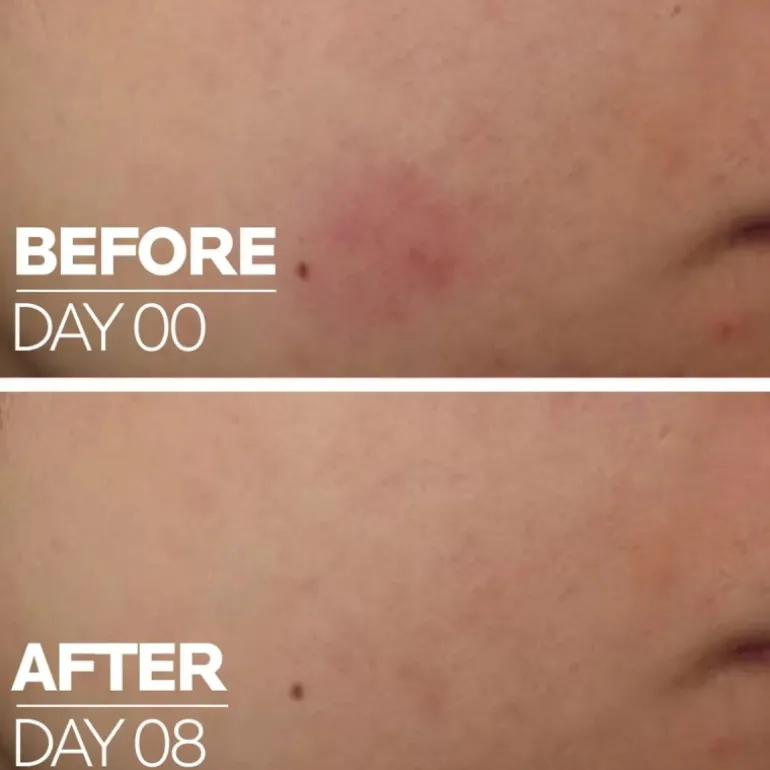 CICAPLAST B5 SÉRUM CON 10 % DE VITAMINA B5