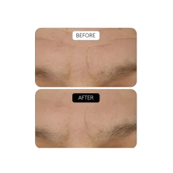 Clinical Beauty Filler Duo