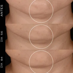 RENERGIE H.P.N. 300-PEPTIDE CREAM