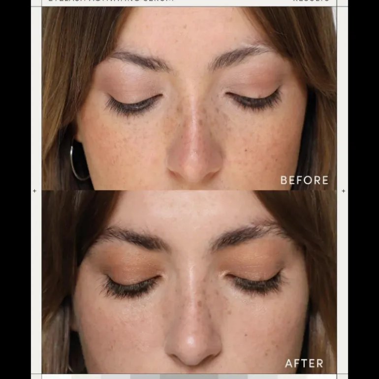 Set Eyelash Activating Serum & Eyebrow Renerwing Serum